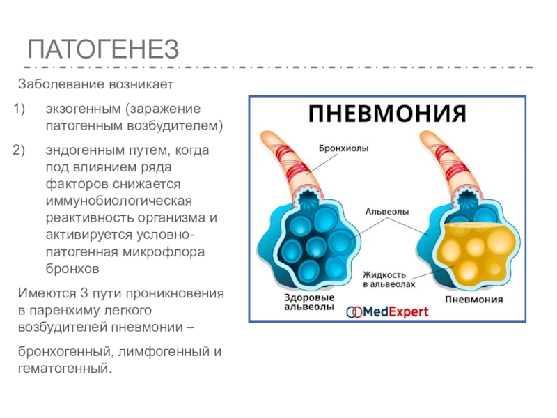 Острое воспаление патогенез. Механизм развития пневмонии. Патогенез острой пневмонии. Патогенез острого воспаления. Патогенез пневмонии при панкреатите.