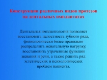 Конструкции различных видов протезов на дентальных имплантатах