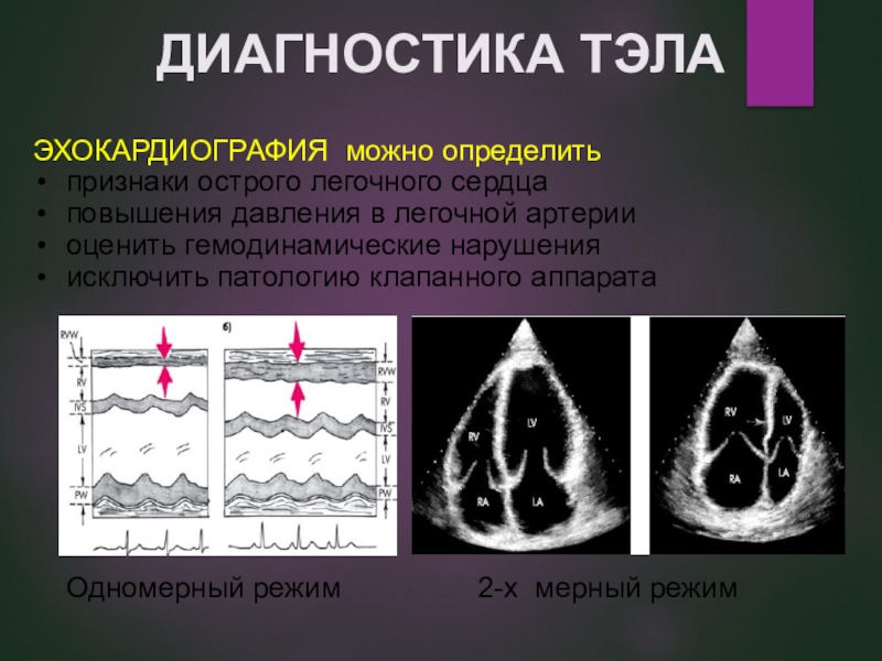 Эхокардиография сердца презентация