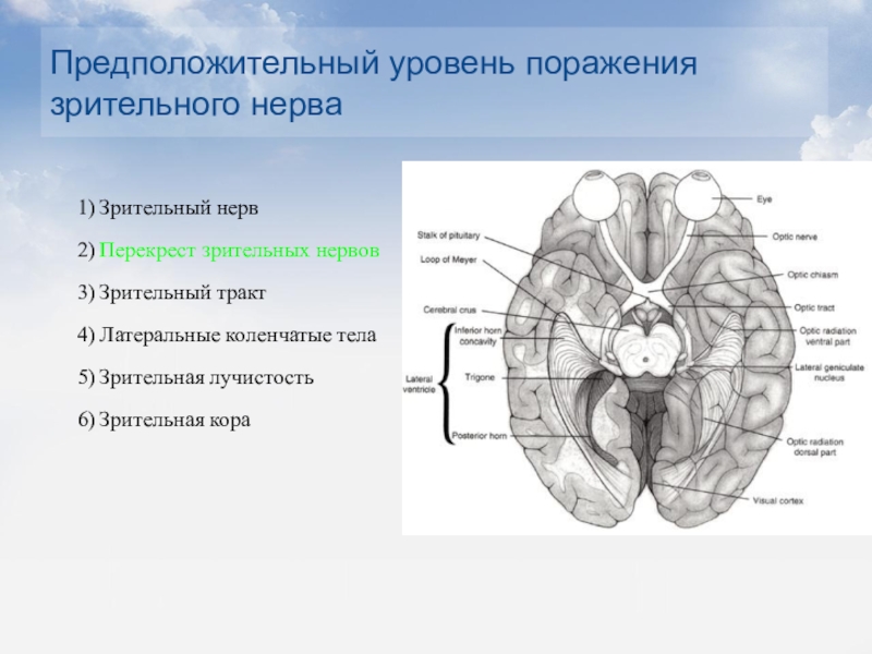 Зрительный нерв в головной мозг. Зрительный путь головной мозг вид снизу. Зрительный нерв тракт и Перекрест. Перекрест зрительного нерва. Перекрест нервных путей зрительного анализатора.
