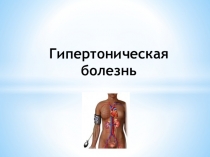 Гипертоническая болезнь