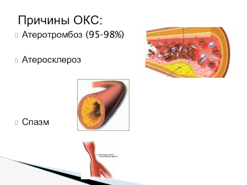 Окс картинки для презентации