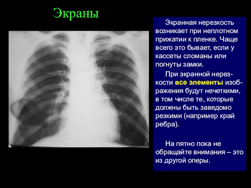 Причины нерезкости изображения