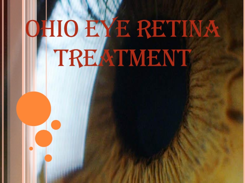 Ohio eye retina treatment
