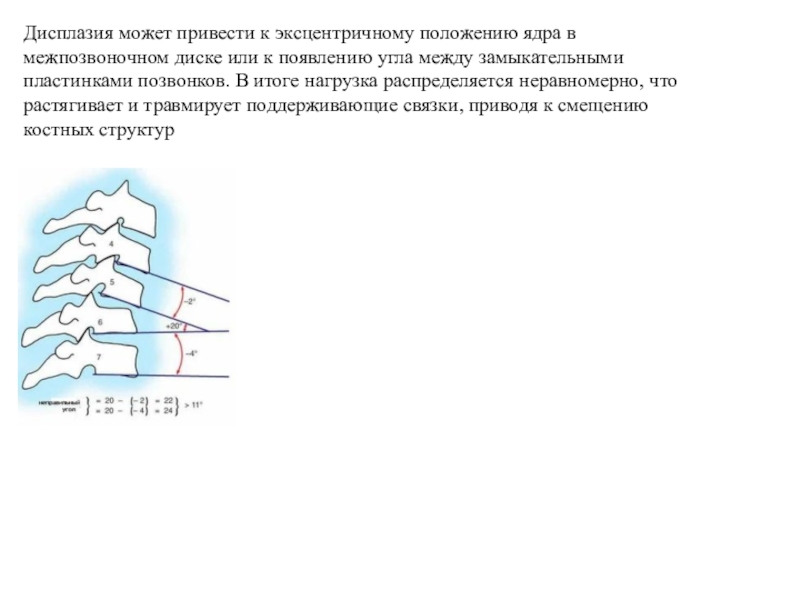 Нестабильность шейного отдела с2