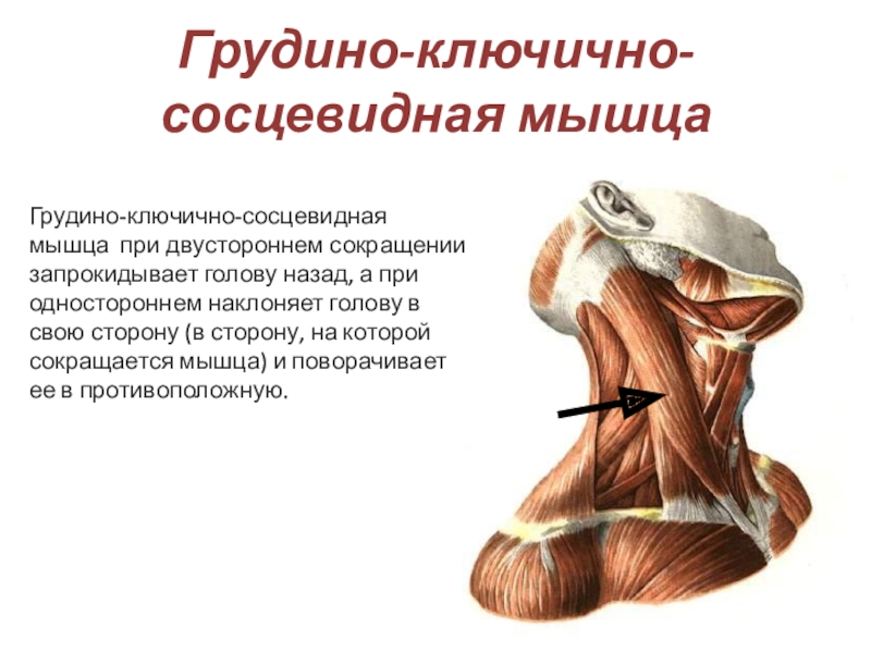 Мускулюс стерноклеидомастоидеус