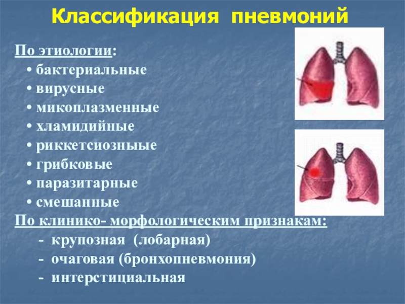 Пневмония картинки для презентации