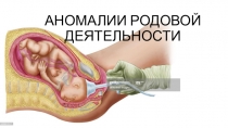 АНОМАЛИИ РОДОВОЙ ДЕЯТЕЛЬНОСТИ