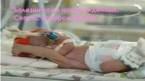 Болезни новорождённых