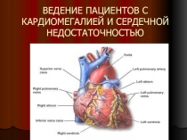 ВЕДЕНИЕ ПАЦИЕНТОВ С КАРДИОМЕГАЛИЕЙ И СЕРДЕЧНОЙ НЕДОСТАТОЧНОСТЬЮ