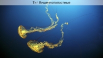 Тип Кишечнополостные