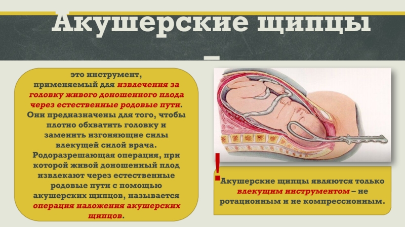 Презентация на тему акушерские щипцы