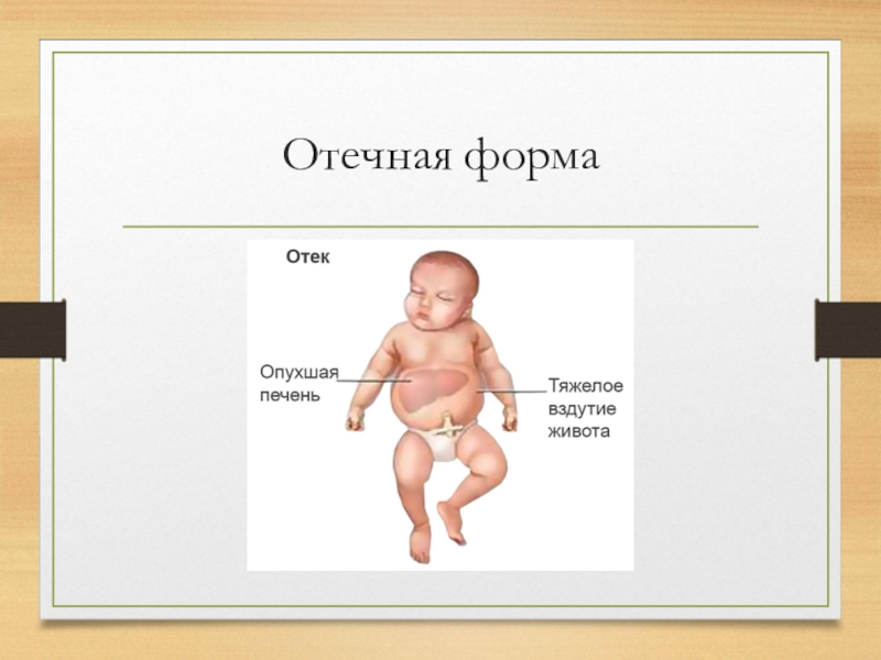 Гемолитическая болезнь новорожденных картинки