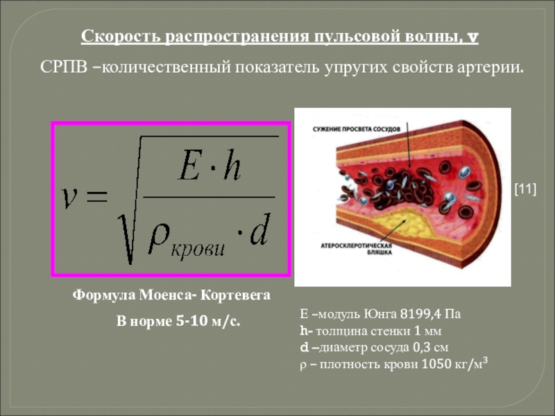 Формула распространения. Скорость пульсовой волны формула. Модель кинетики кровотока модель Франка. Измерение скорости пульсовой волны. Каротидная скорость пульсовой волны.