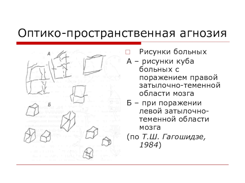 Тактильная агнозия текстуры объекта