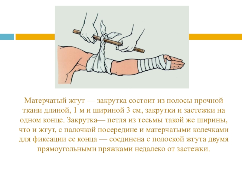 Наложение давящей повязки жгута закрутки. Величина петли закрутки жгута. Матерчатый жгут закрутка. Наложение жгута закрутки. Наложение жгута или закрутки.