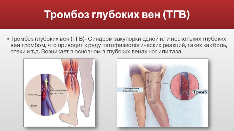 Карта вызова тромбоз вен