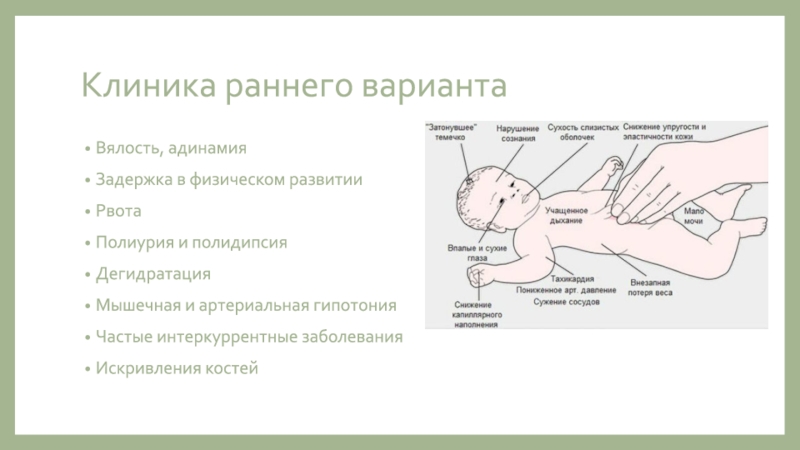 Синдром дебре де тони фанкони презентация