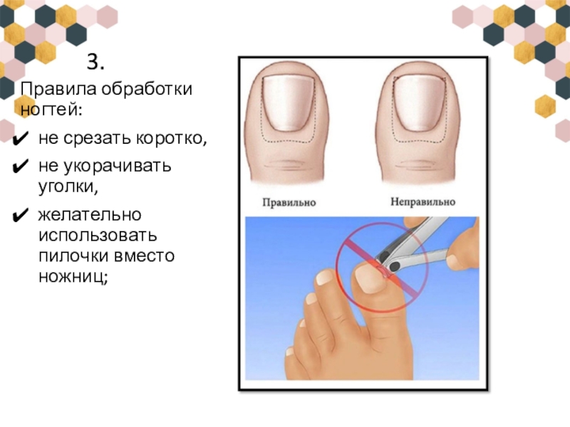 3.Правила обработки ногтей:не срезать коротко,не укорачивать уголки, желательно использовать пилочки вместо ножниц;