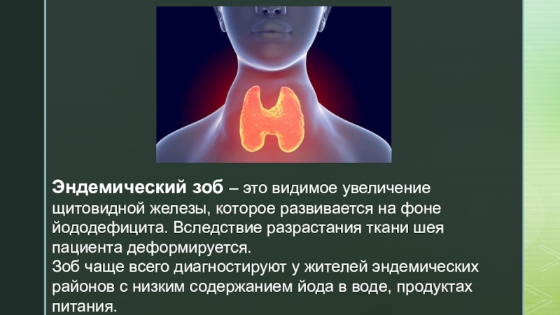 Йододефицит эндемическое заболевание презентация