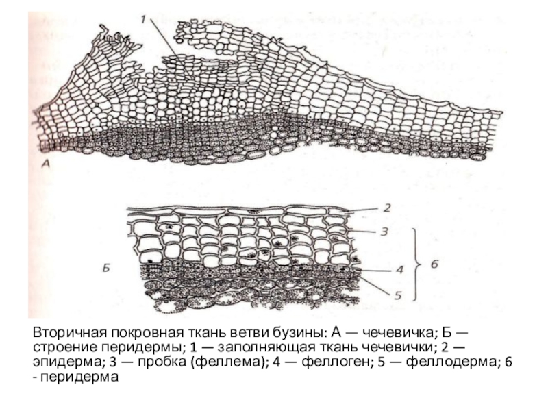 Заполняющая ткань. Покровная ткань растений чечевички. Перидерма бузины. Перидерма и чечевички бузины красной. Феллоген - пробка - эпидерма - 4 феллодерма - перидерма.