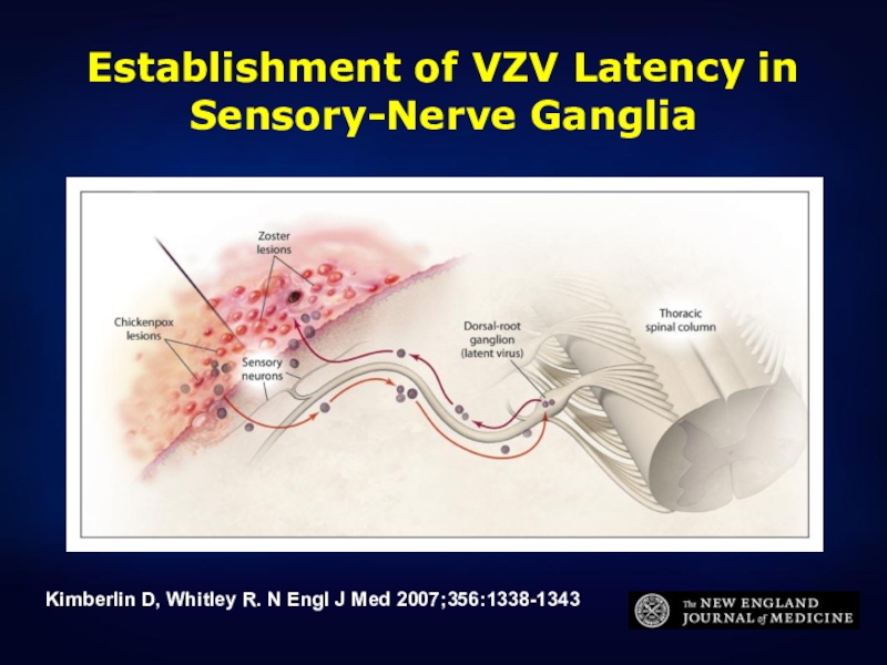 Establishment of VZV Latency in Sensory-Nerve Ganglia Kimberlin D, Whitley R. N Engl J Med 2007;356:1338-1343