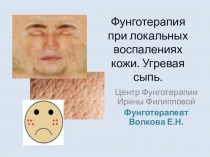 Фунготерапия при локальных воспалениях кожи. Угревая сыпь