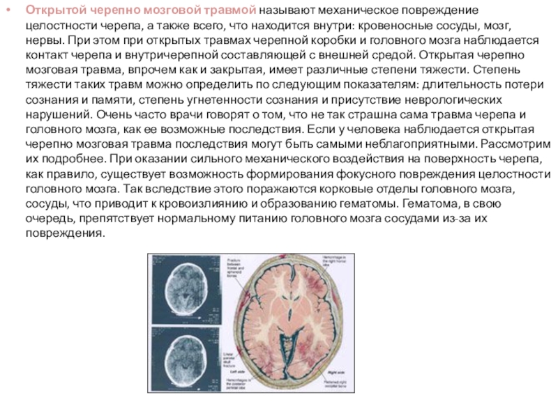 12 черепно мозговая. Дифференциальная диагностика черепно-мозговых травм таблица. Черепно мозговая травма у собаки. Черемномозговая травма у уота.