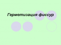 Герметизация фиссур