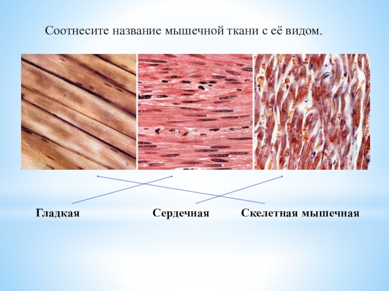 Как называется клетка мышечной ткани. Мышечная ткань название ткани. Мышечная ткань текстура. Мышечная ткань презентация. Клетки мышц называются.