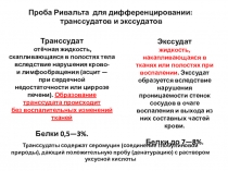 Проба Ривальта для дифференцировании:
транссудатов и