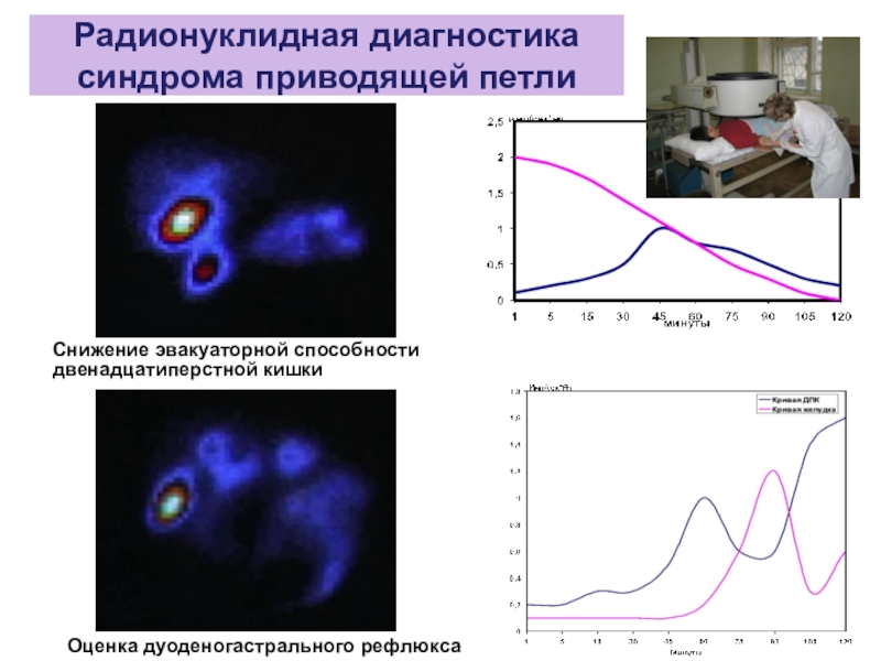 Радионуклидная диагностика. Радионуклидное исследование желудка. Радионуклидный метод диагностики позволяет оценить. Радионуклидная диагностика заболеваний ЖКТ.