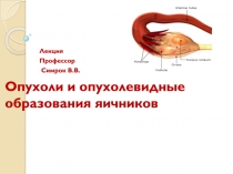 Опухоли и опухолевидные образования яичников