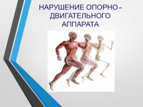 НАРУШЕНИЕ ОПОРНО-ДВИГАТЕЛЬНОГО АППАРАТА