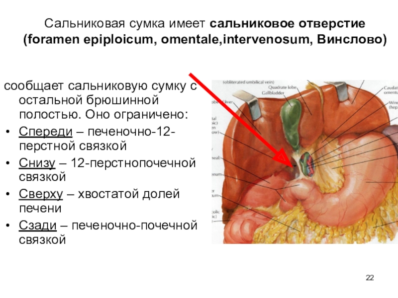 Схема формирования сальниковой сумки