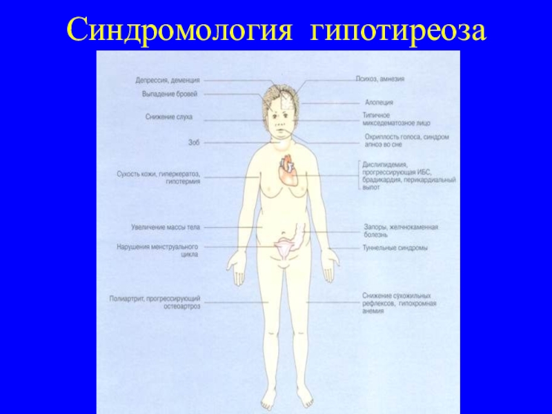 Гипертиреоз гипотиреоз презентация