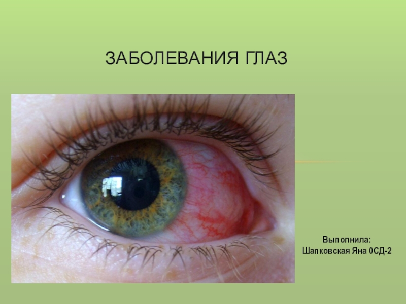 Презентация Заболевания глаз