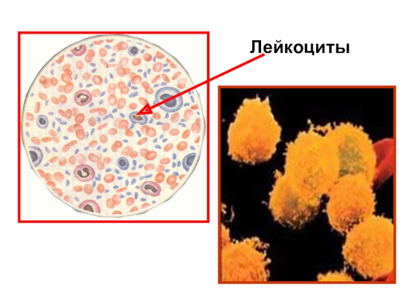 Лейкоциты как выглядят на картинке