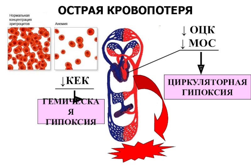 Гипоксия картинки для презентации