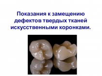 Показания к замещению дефектов твердых тканей искусственными коронками