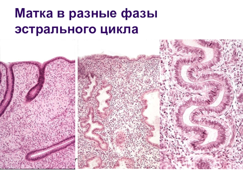 Рисунок матки гистология