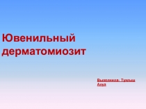 Ювенильный дерматомиозит
Выполнила: Тұңғыш Алуа