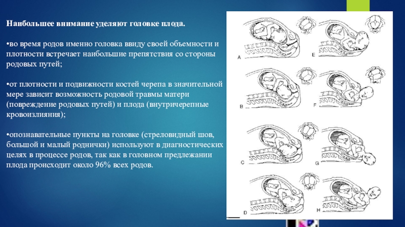 Прямой размер головки плода. Плод объект родов. Ориентиры на головке плода. Головка плода как объект родов. Крупная головка плода.