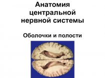 Анатомия центральной нервной системы Оболочки и полости