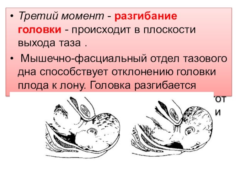 Презентация биомеханизм родов при переднем и заднем виде затылочного предлежания