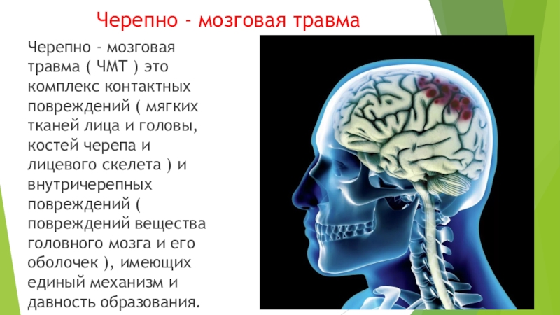 Травмы черепа и головного мозга. Черепная мозговая травма. Черепно-мозговая травма (ЧМТ) сотрясение головного мозга (СГМ). Черепно-мозговая травма презентация. Травмы головного мозга презентация.