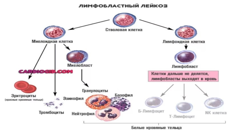 Лейкоз прошел. Презентация на тему острый лейкоз. Симптомы острого лейкоза кратко. Лейкоз риск развития. Острый лейкоз картинки.