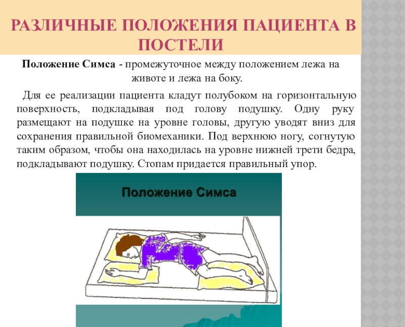 Положение на животе. Положение пациента на животе. Положение пациента в постели симса. Положение пациента в постели на животе. Расположение пациента в положении симса.