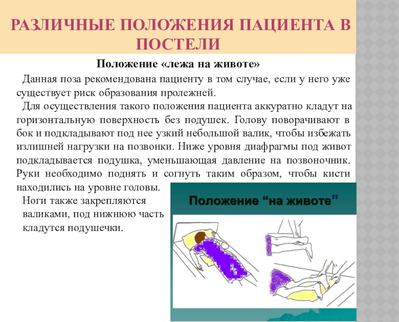 Положение на 18. Виды положения больного в постели. Виды положения пациента.