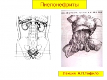 Пиелонефриты